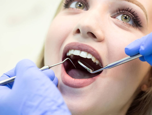 Close-up foto van jonge vrouw zittend in de tandarts stoel met geopende mond bij tandarts kantoor terwijl het hebben van onderzoek. - Foto, afbeelding