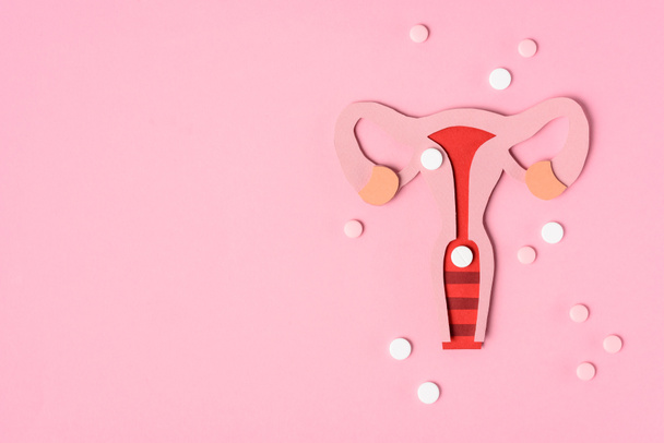 vista superior del sistema reproductor femenino y píldoras en rosa
 - Foto, Imagen