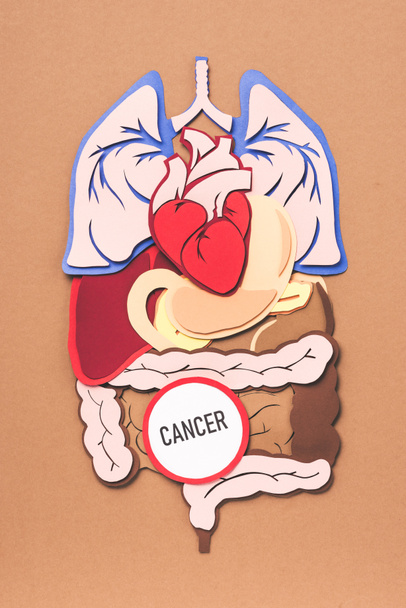 plano con órganos internos humanos y cáncer de letras en marrón
 - Foto, Imagen