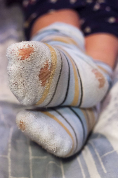 El tiempo de vida de los calcetines depende de una calidad del textil, en otras palabras, del fabricante, también de su pasión por los calcetines, con qué frecuencia los pone y del destino y la fortuna, por supuesto
 - Foto, imagen
