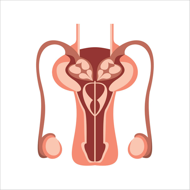 Types Uterine Fibroids, simply vector illustration    - Vettoriali, immagini