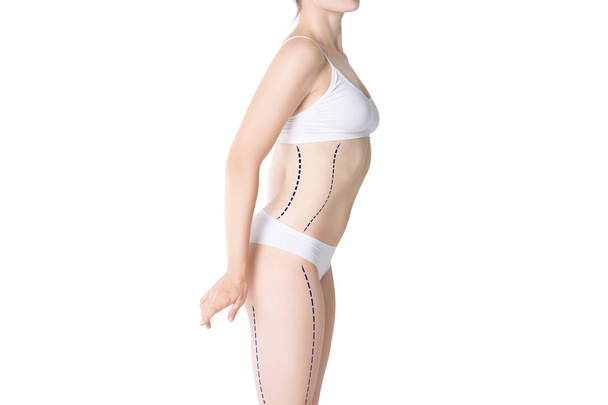 Липосакция, удаление жира и целлюлита, избыточный вес женского тела с покрашенными линиями и стрелками, изолированные на белом фоне
 - Фото, изображение