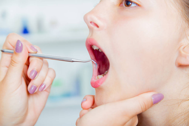Κοντινό πλάνο του μικρού κοριτσιού που ανοίγει το στόμα του ευρύ κατά τη θεραπεία.. - Φωτογραφία, εικόνα