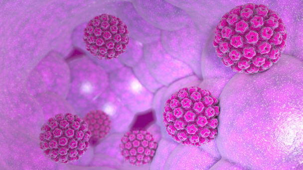 Humán papillomavirus fertőzés. Vírus. HPV a leggyakoribb szexuális úton terjedő fertőzés világszerte. HPV-fertőzés okozza a humán papillomavírus, egy DNS-vírus a papillomavírus család, 3d-leképezés - Fotó, kép