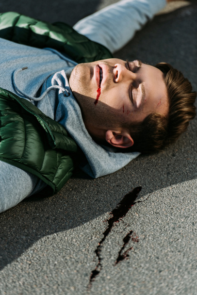 a közúti közlekedési baleset után megsérült fiatal férfi kiadványról - Fotó, kép