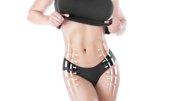 Beautiful and fit female body with the drawing arrows. Plastic surgery, healthy nutrition, liposuction, sport and cellulite removal concept. - Photo, Image
