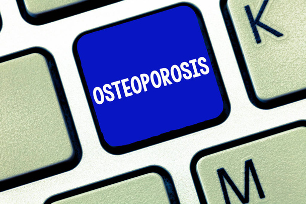 Signo de texto que muestra osteoporosis. Foto conceptual Condición médica en la que los huesos se vuelven frágiles y frágiles
 - Foto, Imagen