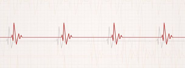 orvostudomány banner bemutató brodycardia. pulzusszám kevesebb, mint 60 ütés / perc - Fotó, kép