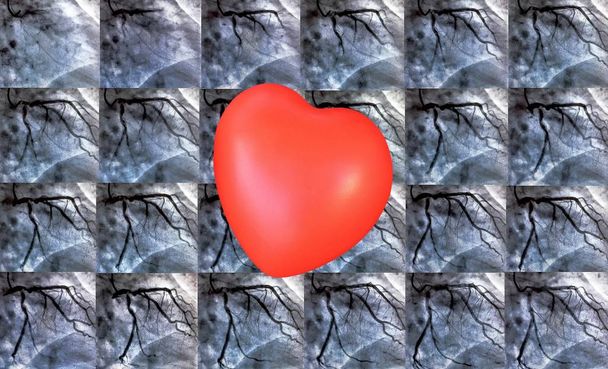 Catheterisatie en kleine rood hart. Cardiale ventriculography is een medische beeldvorming test gebruikt om te bepalen een patiënt hartfunctie in het ventrikel rechts of links - Foto, afbeelding