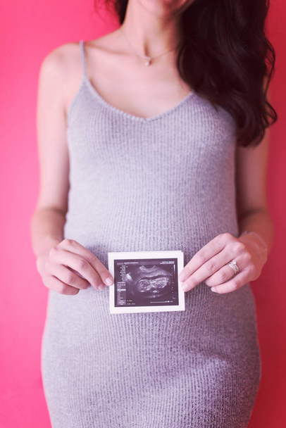 smiling pregnant woman showing ultrasound picture of her unborn baby isolated on red background - Photo, image