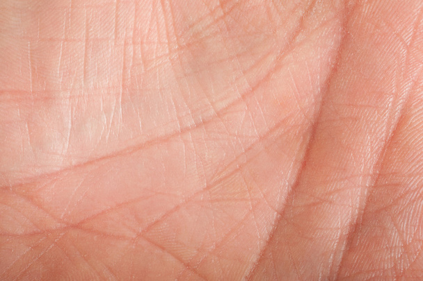 шкіри людини
 - Фото, зображення