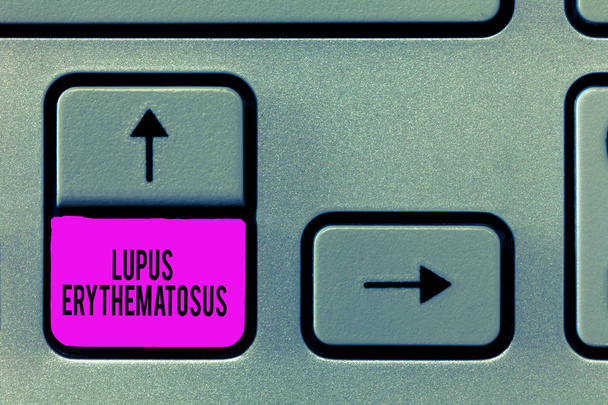 Lupus Eritematozus gösterilen Not yazma. İltihabi durum otoimmün bir hastalığı neden vitrine iş fotoğraf - Fotoğraf, Görsel