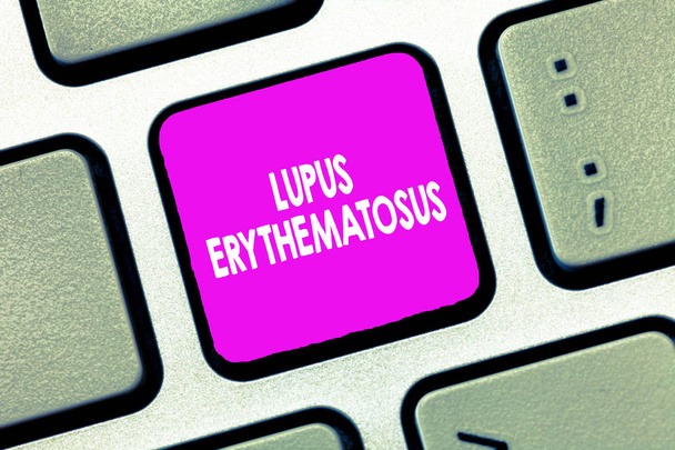 Textzeichen mit Lupus erythematodes. konzeptionelle Foto entzündliche Erkrankung durch eine Autoimmunkrankheit verursacht - Foto, Bild