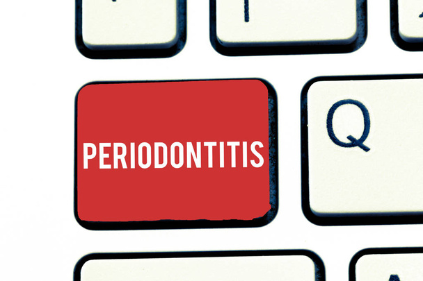 Periodontitis yazma el yazısı metin. Diş dişeti büzülme etrafında doku şişmesi anlam kavramı - Fotoğraf, Görsel