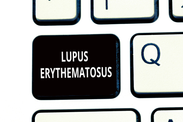 Kavramsal el Lupus Eritematozus gösterilen yazma. İş fotoğraf metin iltihabi durum otoimmün bir hastalığı neden - Fotoğraf, Görsel