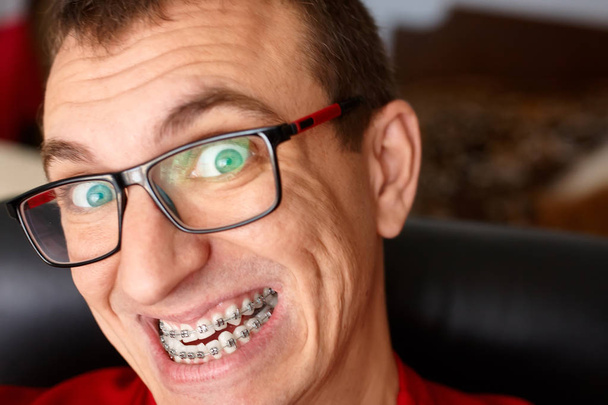 Los dientes curvos del tipo con los aparatos ortopédicos en las gafas se acercan. Retrato del hombre. Cara loca. Expresión feliz
 - Foto, imagen