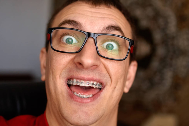 Изогнутые зубы парня с брекетами в очках. Портрет человека. Сумасшедшее лицо. Счастливое выражение
 - Фото, изображение