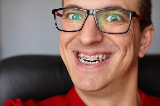 Los dientes curvos del tipo con los aparatos ortopédicos en las gafas se acercan. Retrato del hombre. Cara loca. Expresión feliz
 - Foto, imagen