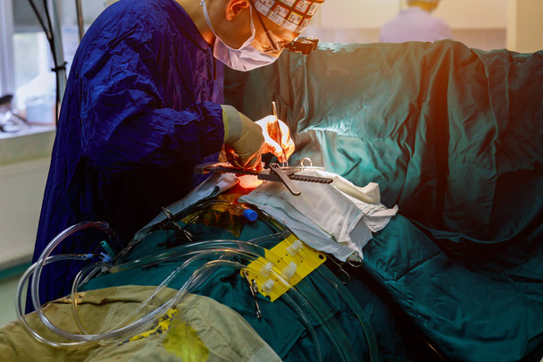 Chirurgen team operationele hart operationele live schot - Foto, afbeelding