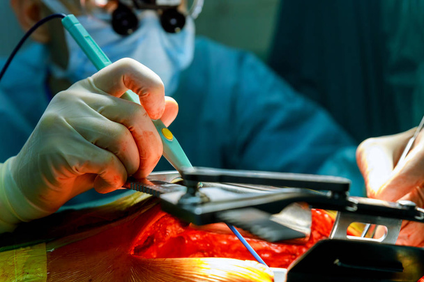 外科医心臓外科医で患者に取り組んで、ハサミを開く手術室 - 写真・画像