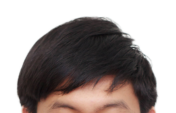Чоловіча голова з симптомами чорного волосся лицьова сторона
 - Фото, зображення
