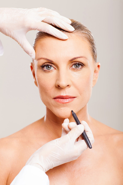 Cosmetic surgeon marking mid age woman - Valokuva, kuva
