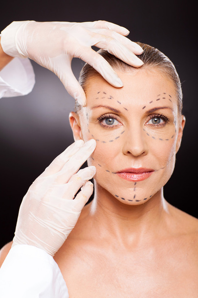 doctor preparing middle aged woman for face lifting surgery - Photo, Image