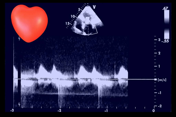 Herz-Ultraschall-Bilder und kleine Herzen. Bildschirm der Echokardiographie-Maschine. doppeltes Echo - Foto, Bild