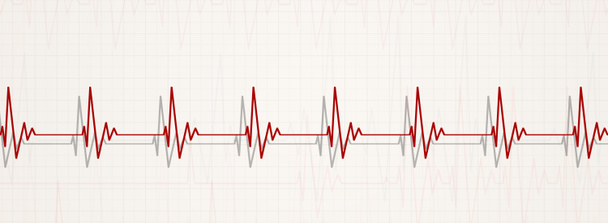 orvostudomány banner bemutató normál szív verni. pulzusszám 60-90 ütés / perc között - Fotó, kép