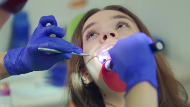 Branqueamento do material de enchimento dentário. Fechar dentista fazendo procedimento
 - Filmagem, Vídeo