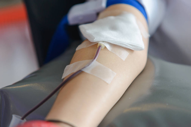 血を受けると手にゴム製のボールを保持しているアジア人の男性の右腕を閉じます。ヘルスケアおよび慈善。輸血の血の寄付。世界献血者デー - 写真・画像