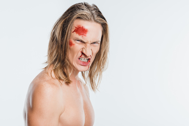 Wütender Mann mit blutigen Wunden im Gesicht, die Zähne isoliert auf weiß zeigen - Foto, Bild