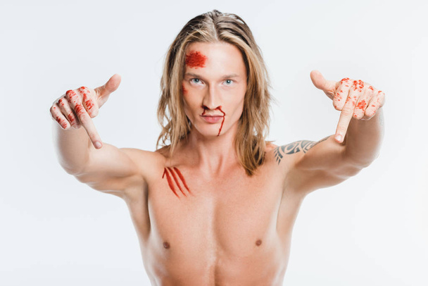 nude handsome man with bloody wounds showing middle fingers isolated on white - Photo, Image