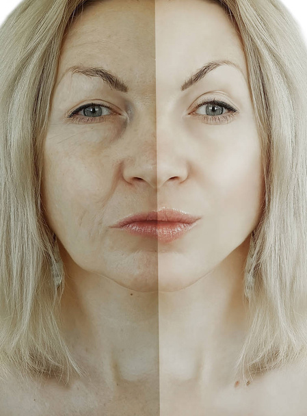 arrugas de la mujer cara antes y después del envejecimiento concepto
 - Foto, imagen