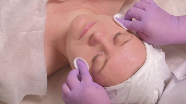 Ευρωπαϊκό μεσήλικας γυναίκα σε μια καλλυντική διαδικασία. Ένα επαγγελματικό cosmetologist σε λιλά γάντια σκουπίζει το δέρμα του ένα γυναικείο πρόσωπο γύρω από τα μάτια, λαιμό και μάγουλα χρησιμοποιώντας μαξιλάρια βαμβάκι. - Φωτογραφία, εικόνα
