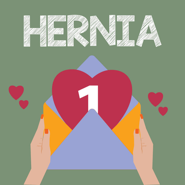Escritura manual conceptual que muestra a Hernia. Texto de la foto comercial Salida anormal de tejido u órgano a través de la pared de la cavidad
 - Foto, Imagen