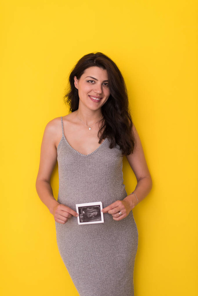 smiling pregnant woman showing ultrasound picture of her unborn baby isolated on yellow background - Valokuva, kuva