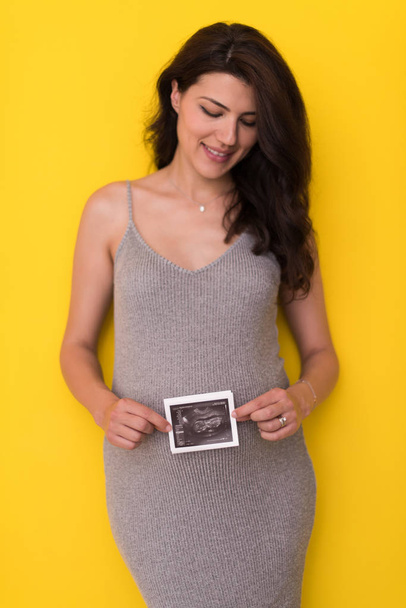 hymyilevä raskaana oleva nainen, joka näyttää ultraäänikuvan syntymättömästä lapsestaan eristettynä keltaisella taustalla
 - Valokuva, kuva