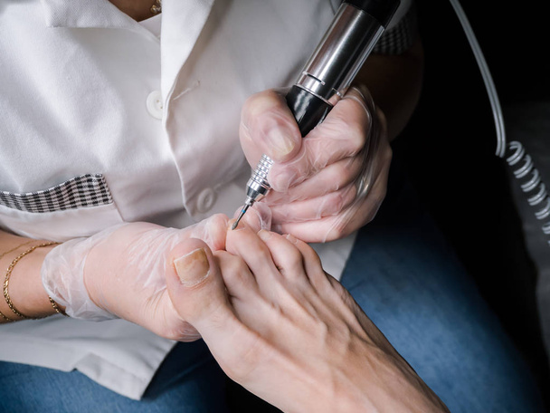 Лікування кутикули на нігтях ніг
. - Фото, зображення