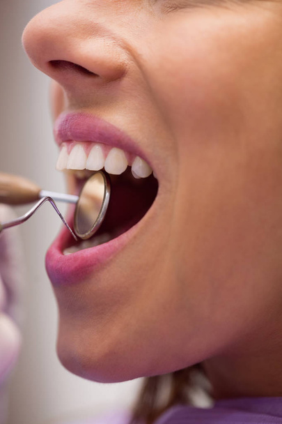 Primer plano del dentista examinando a una paciente con herramientas en la clínica dental
 - Foto, imagen