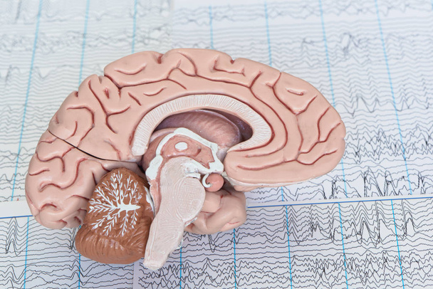 Modelo de cérebro humano no fundo das ondas cerebrais da eletroencefalografia
 - Foto, Imagem