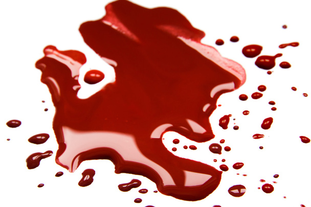 Blood stains (puddle) - Photo, Image