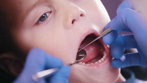 Odontologia. O dentista examina os dentes de leite. Fechar
 - Filmagem, Vídeo