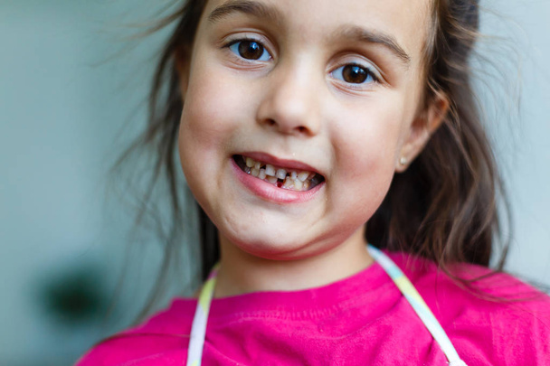 Diş boşluklarını gösteren pembe tişörtlü küçük kız  - Fotoğraf, Görsel