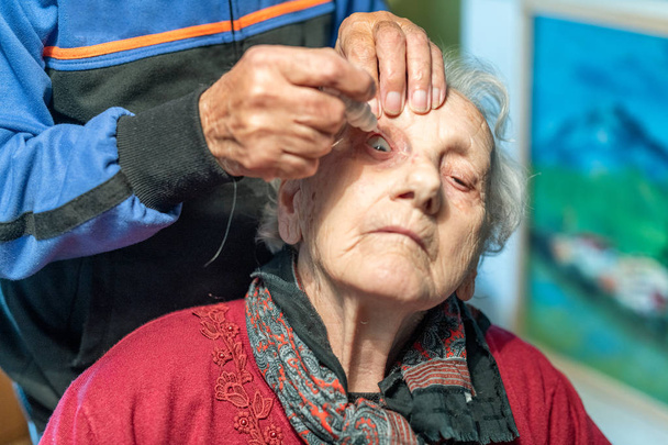 Anciano poniendo colirio en el ojo de su esposa. - Foto, Imagen