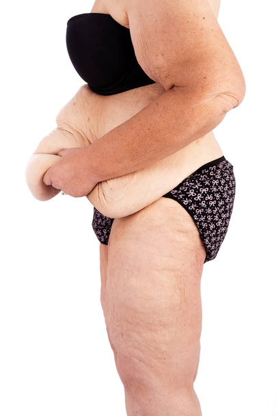 Femme d'âge moyen avec la peau affaissée après une perte de poids extrême
 - Photo, image