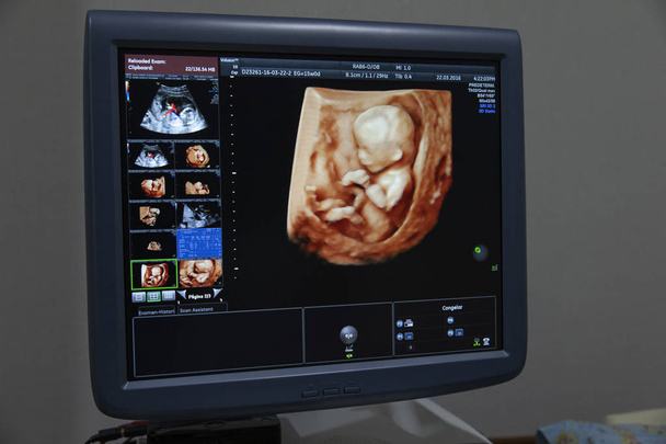 Παρακολουθεί με μωρό εικόνες κατά τη διαδικασία της κυοφορίας. Κλινική γονιμότητας. - Φωτογραφία, εικόνα