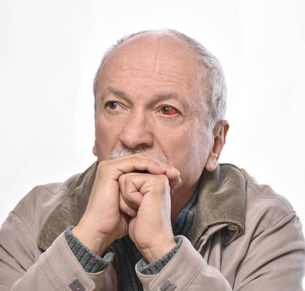 Старший чоловік з роздратованим червоним кров'яним оком на білому тлі
 - Фото, зображення