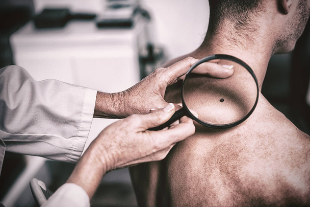 Dermatologist examining mole with magnifying glass in clinic - Фото, зображення
