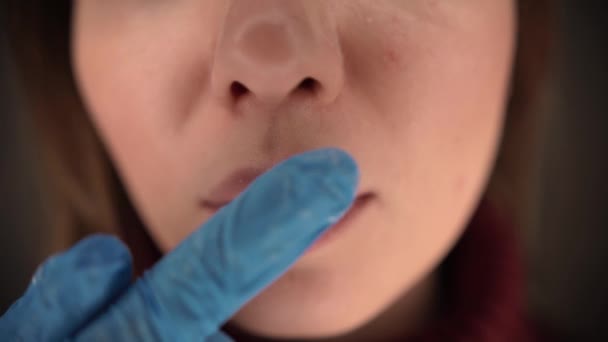 herpes on the lips, part of a womans face with finger on lips with herpes, beauty concept - Séquence, vidéo